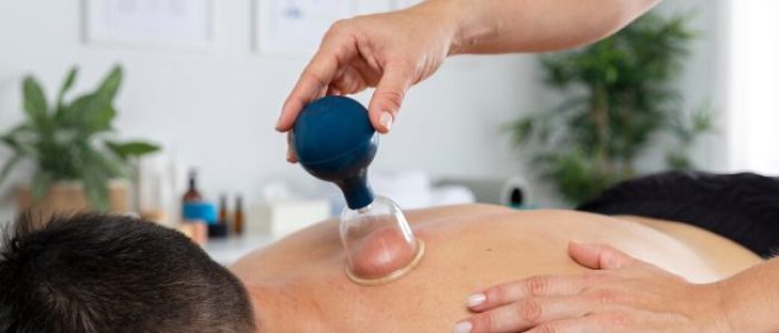 Miofacial Liberação Miofascial Com Ventosas